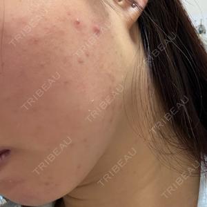 ルラ美容クリニック ルラ美容クリニック 横浜院口コミ