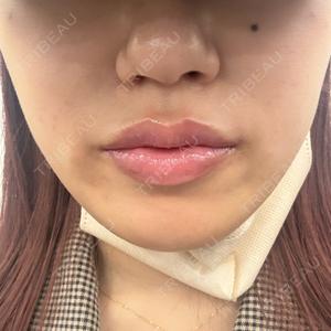 銀座美容外科クリニック 銀座美容外科クリニック 銀座院口コミ