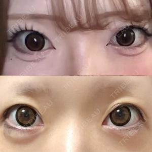 口コミ