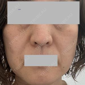ルラ美容クリニック ルラ美容クリニック 横浜院口コミ