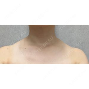 BiBiクリニック口コミ