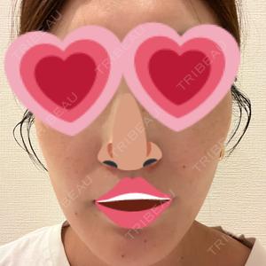 Chloe Cheongdam Clinic （クロエチョンダムクリニック）口コミ