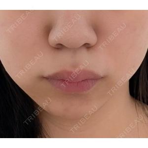 DMTC CLINIC DMTC CLINIC 日本橋院口コミ