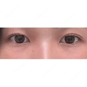 AYANAフィラーズクリニック AYANAフィラーズクリニック 渋谷院口コミ
