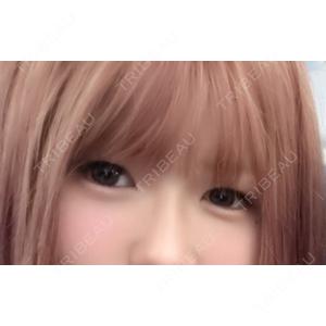 湘南美容クリニック 湘南美容クリニック 千葉センシティ院口コミ