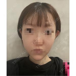 Chloe Cheongdam Clinic （クロエチョンダムクリニック）口コミ
