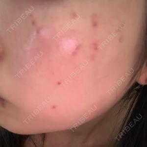 Chloe Cheongdam Clinic （クロエチョンダムクリニック）口コミ