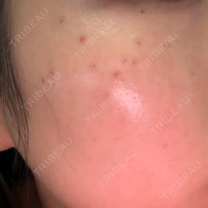 Chloe Cheongdam Clinic （クロエチョンダムクリニック）口コミ