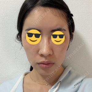 ZX-CLINIC ZX-CLINIC 梅田院口コミ