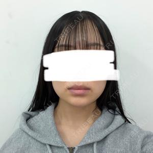 DMTC CLINIC DMTC美容皮膚科 大宮院口コミ