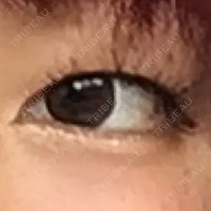 湘南美容クリニック 湘南美容クリニック 京都院口コミ