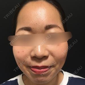 Wクリニック Wクリニック 心斎橋院口コミ