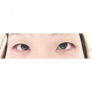 口コミ