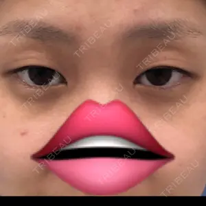 口コミ