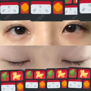 湘南美容クリニック 湘南美容クリニック 東京蒲田院口コミ