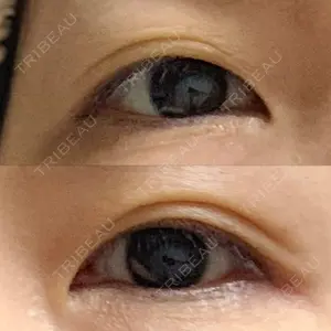 湘南美容クリニック 湘南美容クリニック 東京蒲田院口コミ