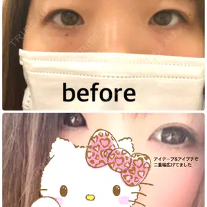 口コミ