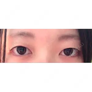 口コミ