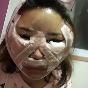 RG整形外科（旧リオン整形外科）口コミ