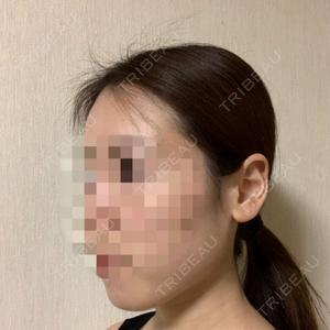 RG整形外科（旧リオン整形外科）口コミ
