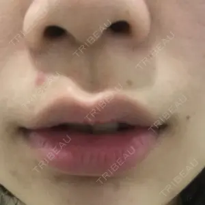 B-LINE CLINIC B-LINE CLINIC 池袋院口コミ