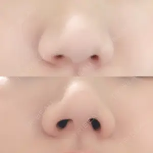 口コミ