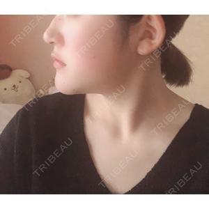 東京美容外科 東京美容外科 赤坂院口コミ