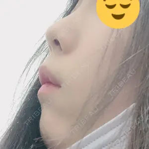 口コミ