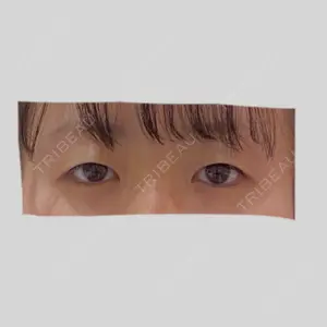 RG整形外科（旧リオン整形外科）口コミ