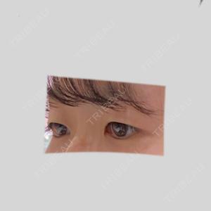 RG整形外科（旧リオン整形外科）口コミ