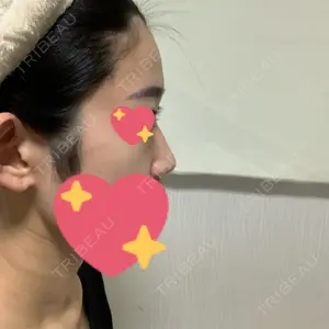 Lovelyan整形外科口コミ