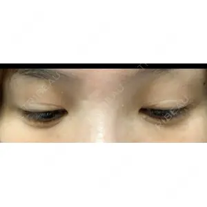 RG整形外科（旧リオン整形外科）口コミ