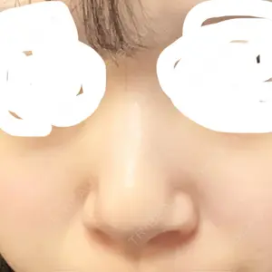 マーブル整形外科口コミ