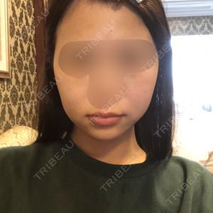 プチパーティー医院口コミ