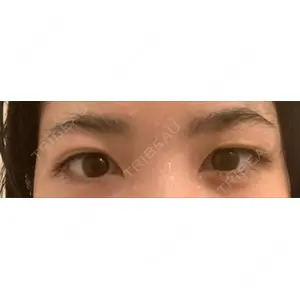 福岡天神クリニック口コミ