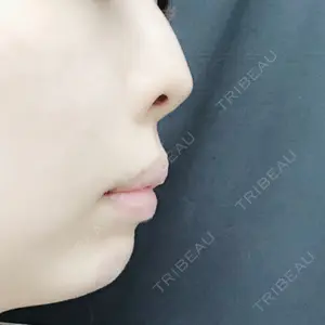 TCB東京中央美容外科 TCB東京中央美容外科 中野院口コミ