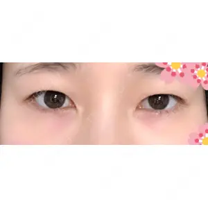 プロミス整形外科口コミ
