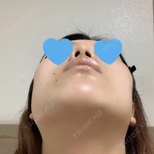 FROM B整形外科 (旧バウム整形外科)口コミ