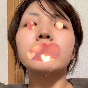 口コミ