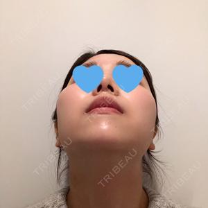 RG整形外科（旧リオン整形外科）口コミ