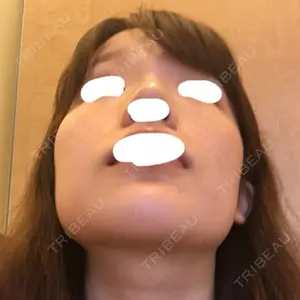 TL美容整形外科 TL美容整形外科 顔面輪郭・目・鼻センター口コミ