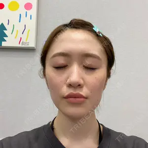 ボンディ美容整形外科（旧リオン整形外科）口コミ