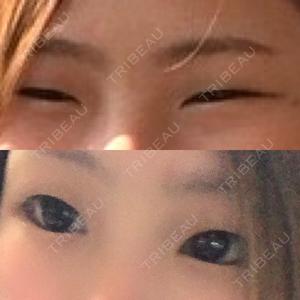 口コミ