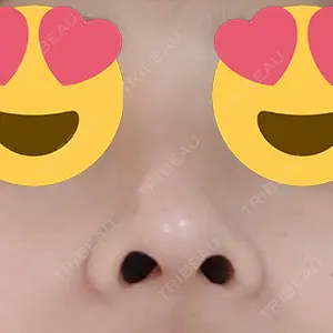 マーブル美容整形外科の