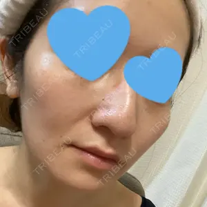 RG整形外科（旧リオン整形外科）口コミ