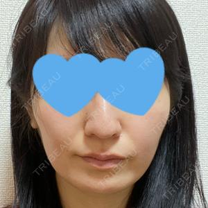 RG整形外科（旧リオン整形外科）口コミ