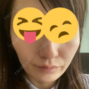 RG整形外科（旧リオン整形外科）口コミ