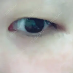 湘南美容クリニック 湘南美容クリニック 京都院口コミ