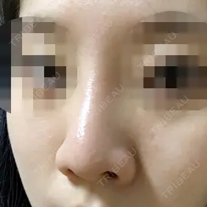 マーブル美容整形外科の