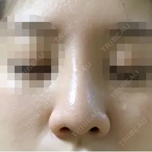マーブル美容整形外科の